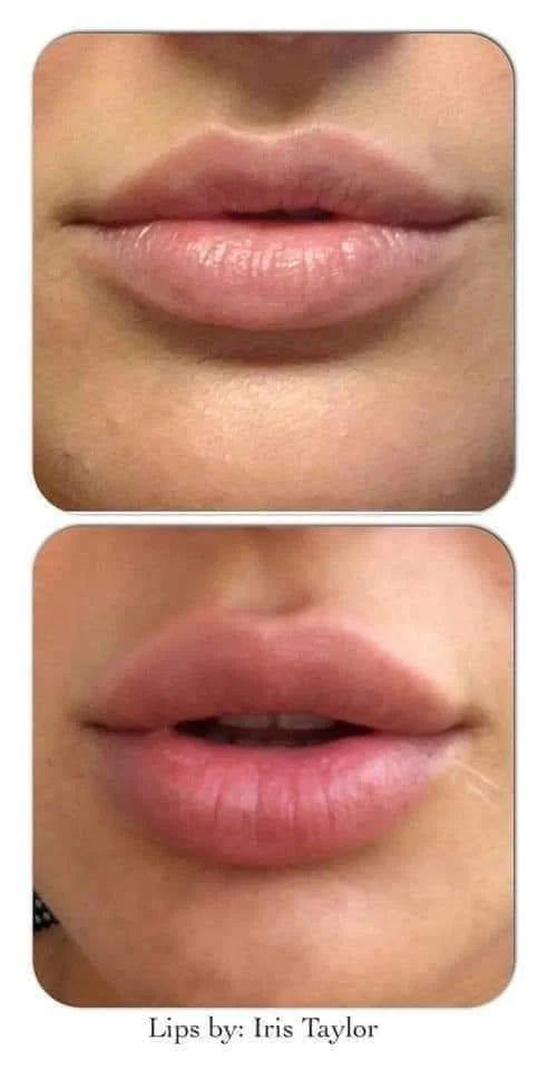 GLOSS BOTOX